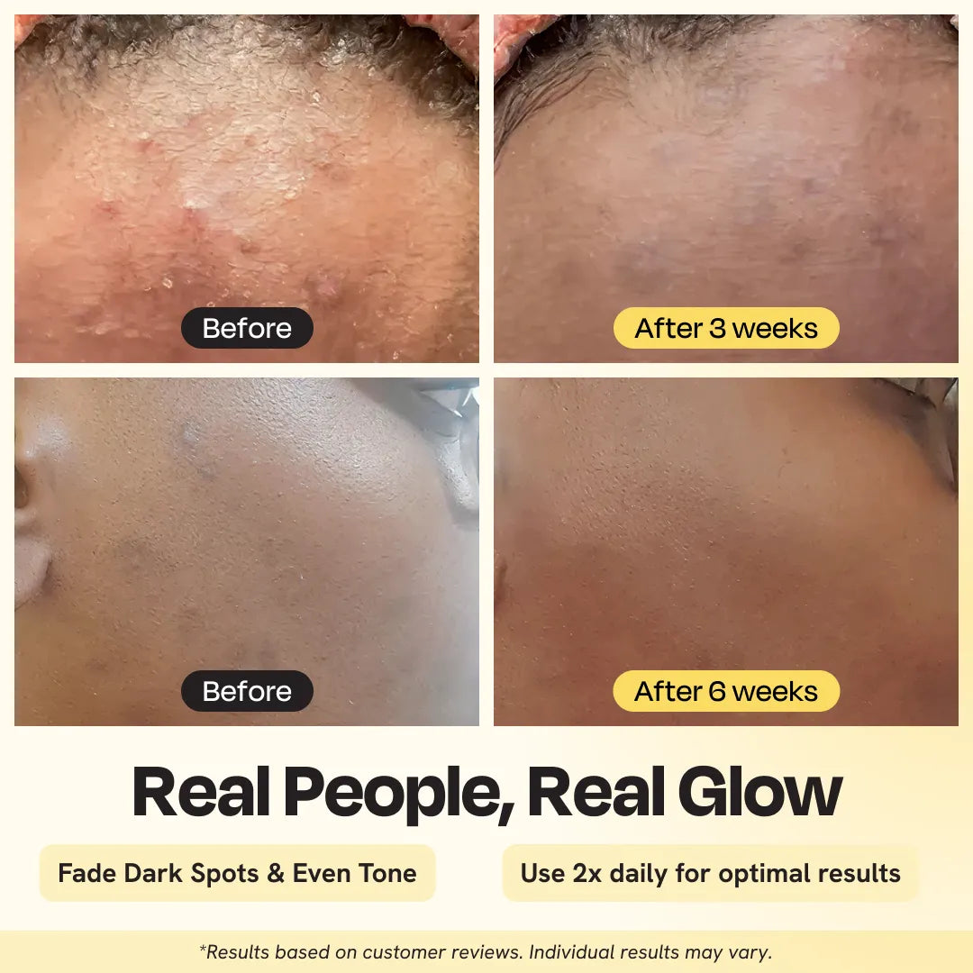 Radiant Glow Moisturizer